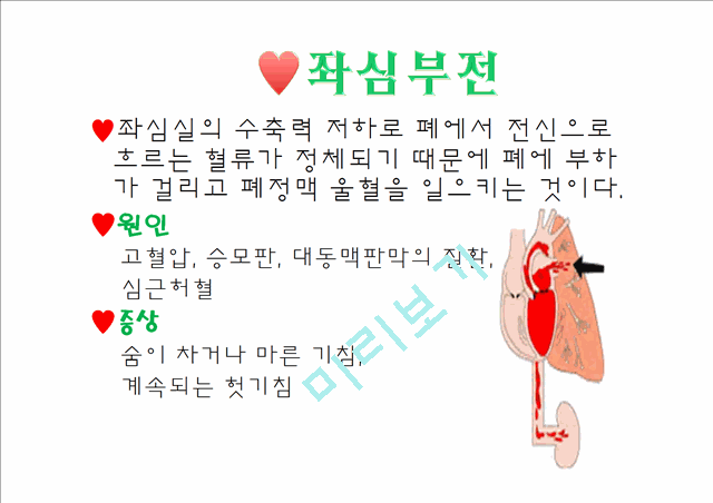 [의학]심폐물리치료 - 심장기능부전에 관해.pptx